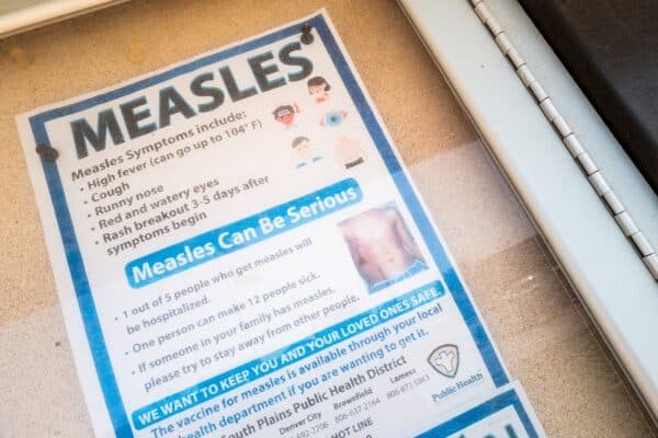 Michigan reports first confirmed the measles outbreak since 2019