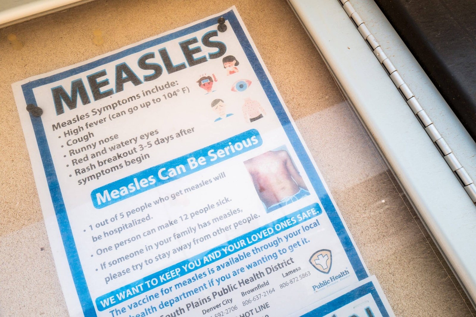 Michigan reports first confirmed the measles outbreak since 2019
