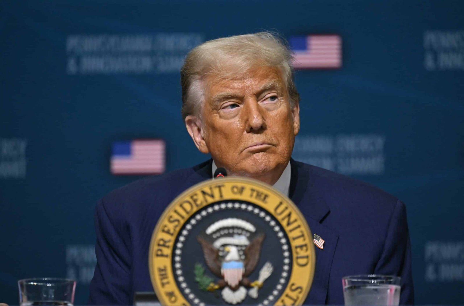 What is chronic venous insufficiency? All to know about Trump's diagnosis